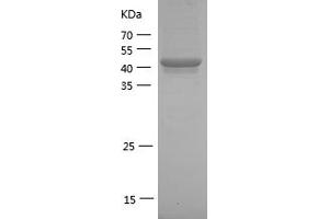 Western Blotting (WB) image for Interleukin-1 Receptor-Associated Kinase 1 (IRAK1) (AA 504-712) protein (GST tag) (ABIN7123626) (IRAK1 Protein (AA 504-712) (GST tag))
