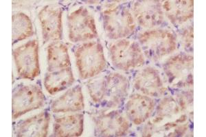 Formalin-fixed and paraffin embedded mouse intestine labeled with Anti-RPLP0 Polyclonal Antibody, Unconjugated  at 1:200 followed by conjugation to the secondary antibody and DAB staining