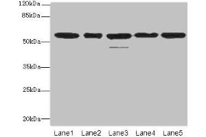 Western blot All lanes: RBBP4 antibody at 1 μg/mL Lane 1: Hela whole cell lysate Lane 2: LO2 whole cell lysate Lane 3: K562 whole cell lysate Lane 4: NIH/3T3 whole cell lysate Lane 5: Raji whole cell lysate Secondary Goat polyclonal to rabbit IgG at 1/10000 dilution Predicted band size: 48, 47, 44 kDa Observed band size: 48, 55 kDa (Retinoblastoma Binding Protein 4 anticorps  (AA 246-425))