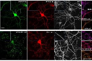anti-Microtubule-Associated Protein 2 (MAP2) antibody