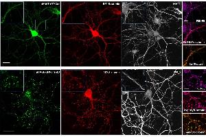 Effect of Shank3 on localization of δ-catenin in neurons.