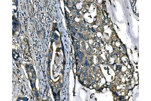 IHC analysis of ATP6V1A using anti-ATP6V1A antibody (ABIN7599916).