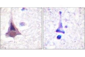 Immunohistochemistry analysis of paraffin-embedded human brain tissue, using MYPT1 (Ab-853) Antibody. (PPP1R12A anticorps  (AA 621-670))