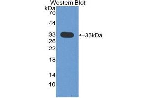 Western Blotting (WB) image for anti-Cyclin-Dependent Kinase 4 (CDK4) (AA 6-295) antibody (ABIN1858347) (CDK4 anticorps  (AA 6-295))