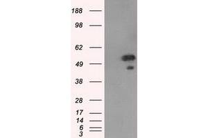 Western Blotting (WB) image for anti-SHC (Src Homology 2 Domain Containing) Transforming Protein 1 (SHC1) antibody (ABIN1499993)