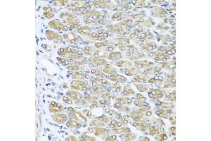 Immunohistochemistry of paraffin-embedded mouse stomach using RAC2 antibody (ABIN5970487) at dilution of 1/100 (40x lens). (RAC2 anticorps)