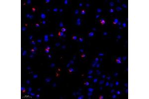 Immunofluorescence of paraffin embedded rat brain using MAP7 (ABIN7074621) at dilution of 1:400 (400x lens)