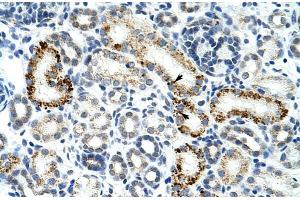 Human Kidney; Rabbit Anti-ZESR2 Antibody. (ZRSR2 anticorps  (C-Term))