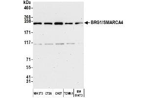 Western Blotting (WB) image for anti-SWI/SNF Related, Matrix Associated, Actin Dependent Regulator of Chromatin, Subfamily A, Member 4 (SMARCA4) (AA 75-125) antibody (ABIN7454677)