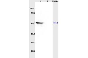 Lane 1: rat brain lysates Lane 2: rat heart lysates probed with Anti MAP3K8/TPL2 Polyclonal Antibody, Unconjugated (ABIN701275) at 1:200 in 4 °C.