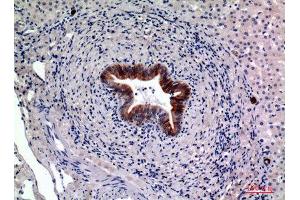 Immunohistochemistry (IHC) analysis of paraffin-embedded Human Liver, antibody was diluted at 1:100. (CD19 anticorps  (Internal Region))