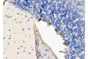 ABIN6266103 and ABIN6278312 at 1/100 staining Rat brain tissue by IHC-P.