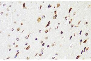 Immunohistochemistry of paraffin-embedded Rat brain using EDF1 Polyclonal Antibody at dilution of 1:100 (40x lens).