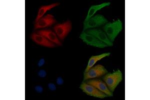 ABIN6257498 and ABIN6275600 staining Hela cells by IF/ICC. (Sorting Nexin 1 anticorps  (Internal Region))