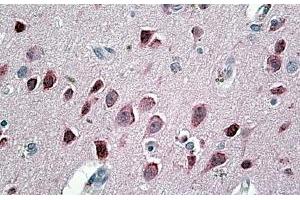 anti-Neurogranin (NRGN) (Internal Region) antibody