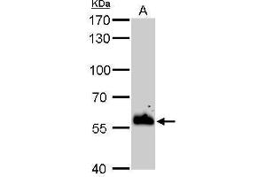 WB Image ERp57 antibody [C3], C-term detects PDIA3 protein by Western blot analysis.