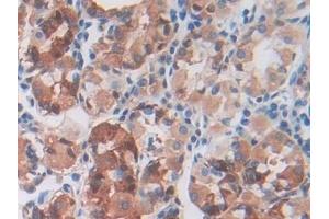 Detection of CDCP1 in Human Stomach Tissue using Polyclonal Antibody to CUB Domain Containing Protein 1 (CDCP1) (CDCP1 anticorps  (AA 689-836))