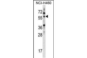 Western blot analysis in NCI-H460 cell line lysates (35ug/lane). (MINPP1 anticorps  (C-Term))