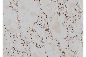 ABIN6273460 at 1/100 staining Human lung tissue by IHC-P. (CENPL anticorps  (Internal Region))