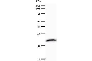 Western Blotting (WB) image for anti-ZINC FINGER PROTEIN 136 (ZNF136) antibody (ABIN932448) (ZNF136 anticorps)