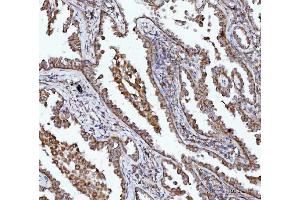 IHC analysis of BBS9 using anti-BBS9 antibody (ABIN7601518). (BBS9 anticorps  (AA 37-793))