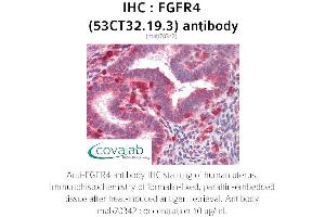 Image no. 2 for anti-Fibroblast Growth Factor Receptor 4 (FGFR4) antibody (ABIN2851987) (FGFR4 anticorps)