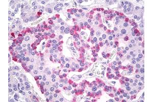 Anti-Glucagon antibody IHC of human pancreas, islets of Langerhans. (Glucagon anticorps  (AA 25-54))