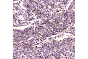 IHC analysis of IGF2R using anti-IGF2R antibody . (IGF2R anticorps  (AA 424-529))