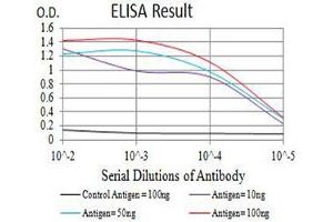 Black line: Control Antigen (100 ng),Purple line: Antigen (10 ng), Blue line: Antigen (50 ng), Red line:Antigen (100 ng)