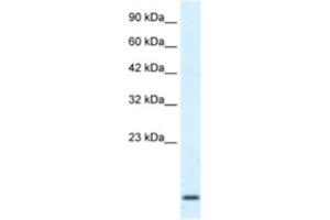 Western Blotting (WB) image for anti-Homeobox A1 (HOXA1) antibody (ABIN2461047) (HOXA1 anticorps)