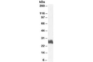 Western blot testing of human bone marrow lysate with FRA1 antibody at 1ug/ml. (FOSL1 anticorps)