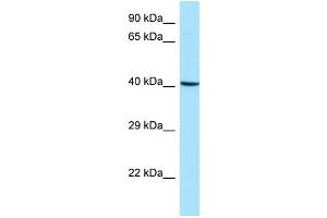 WB Suggested Anti-ARPC1B Antibody Titration: 1.