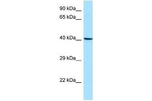WB Suggested Anti-ARPC1B Antibody Titration: 1. (ARPC1B anticorps  (Middle Region))