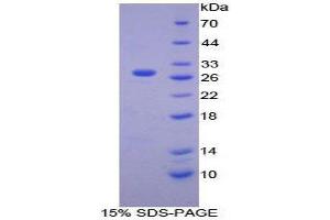 SDS-PAGE (SDS) image for Calcium Independent Phospholipase A2 (PNPLA2) (AA 481-702) protein (His tag) (ABIN2126296) (PNPLA2 Protein (AA 481-702) (His tag))