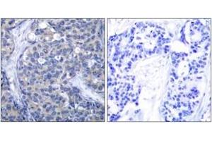 Immunohistochemistry (IHC) image for anti-zeta-Chain (TCR) Associated Protein Kinase 70kDa (ZAP70) (AA 286-335) antibody (ABIN2889082) (ZAP70 anticorps  (AA 286-335))