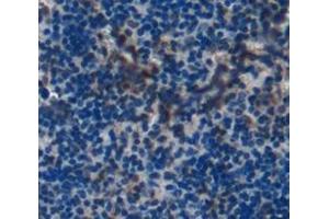 Used in DAB staining on fromalin fixed paraffin- embedded spleen tissue (LTA4H anticorps  (AA 135-272))