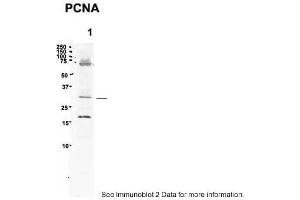 Sample Type: 1. (PCNA anticorps  (C-Term))