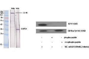Western Blot (WB) analysis of specific cells using IGF-IR Polyclonal Antibody.