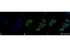 Immunocytochemistry/Immunofluorescence analysis using Rabbit Anti-p53 Polyclonal Antibody .
