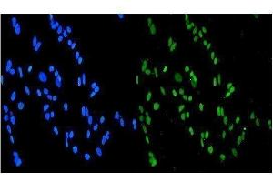 IF analysis of SMURF1 using anti-SMURF1 antibody (ABIN3044547).