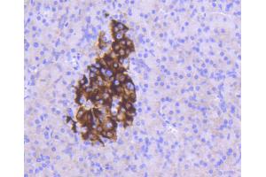 Immunohistochemistry of paraffin-embedded human pancreas using MCL1 antibody (ABIN5997051) at dilution of 1/100 (40x lens). (MCL-1 anticorps)