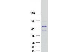 TSPY1 Protein (Myc-DYKDDDDK Tag)