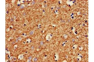 IHC image of ABIN7160401 diluted at 1:400 and staining in paraffin-embedded human brain tissue performed on a Leica BondTM system. (MBP anticorps  (AA 1-197))