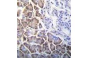 Immunohistochemistry analysis in formalin fixed and paraffin embedded human pancreas tissue reacted with ID1 / BHLHB24 Antibody (Center) followed which was peroxidase conjugated to the secondary antibody and followed by DAB staining.