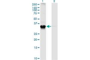 Western Blot analysis of STX4 expression in transfected 293T cell line by STX4A monoclonal antibody (M04), clone 6D1. (Syntaxin 4 anticorps  (AA 19-119))