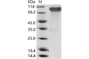 Western Blotting (WB) image for Epstein-Barr Virus Membrane Antigen gp350 (EBV gp350) protein (His tag) (ABIN7198936) (EBV-Gp350 Protein (His tag))