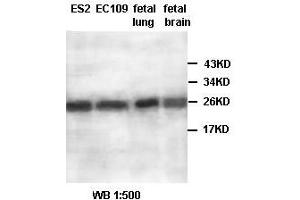 Image no. 2 for anti-Aldo-Keto Reductase Family 1, Member A1 (Aldehyde Reductase) (AKR1A1) antibody (ABIN791183) (AKR1A1 anticorps)