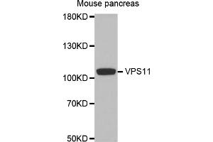 Western blot analysis of extracts of mouse pancreas, using VPS11 antibody. (VPS11 anticorps)