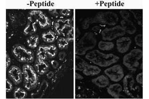 AP32082PU-N SLC26A6 Antibody overnight staining of paraffin embedded Human Kidney at 0. (SLC26A6 anticorps  (Internal Region))