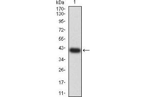 Western blot analysis using F2R mAb against human F2R (AA: 42-176) recombinant protein.